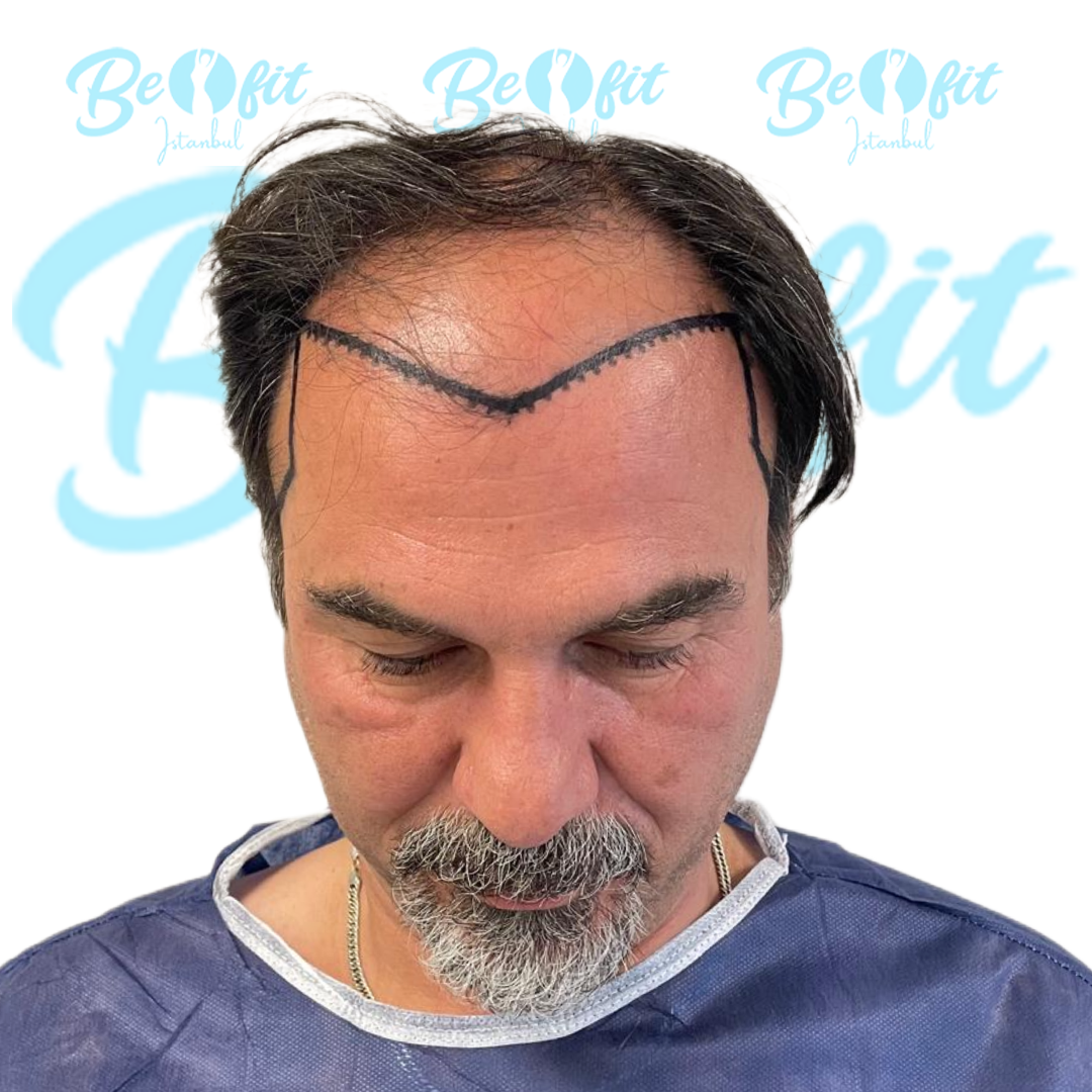 Visible Hair Loss